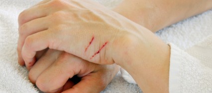 solution-contre-les-cicatrices